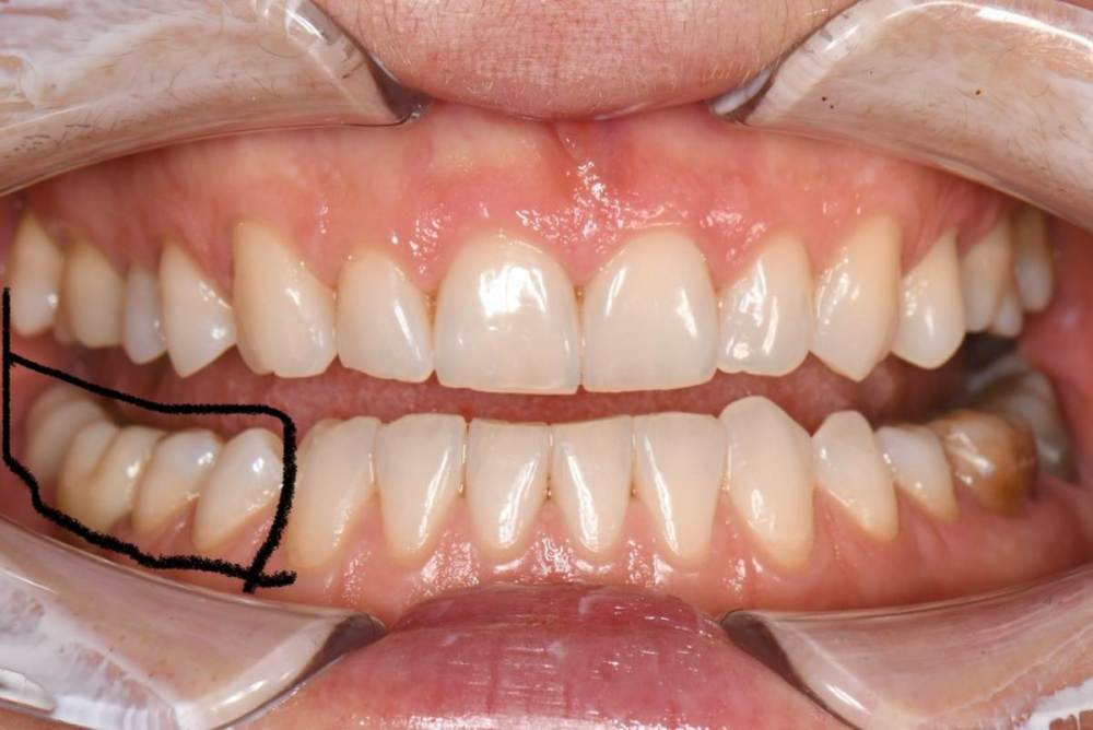 220825095808-Гумеров Н.Р.-общие-Хорошилова Т.Н.eb87a02b7aed4eb3b20dfaea7b4aef0f.jpg