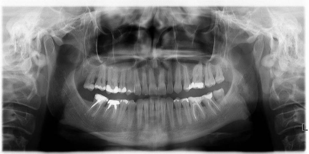 3 ноября  2016 год панорамный снимок полости рта .jpg