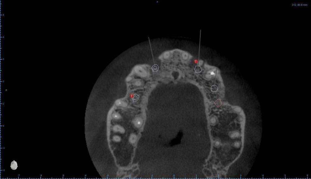 ����� ����� ������������17-Axial View.jpg