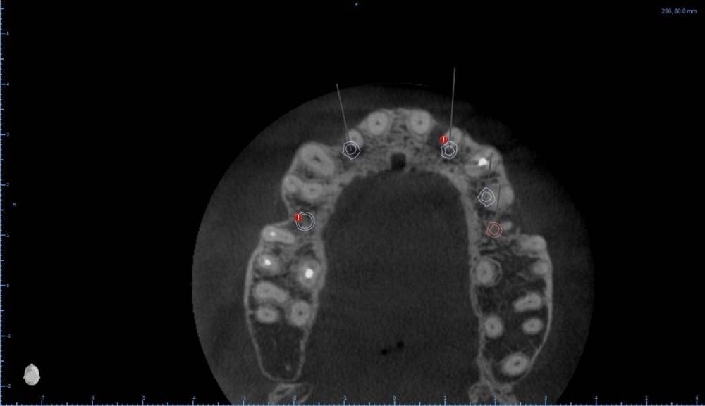 ����� ����� ������������18-Axial View.jpg