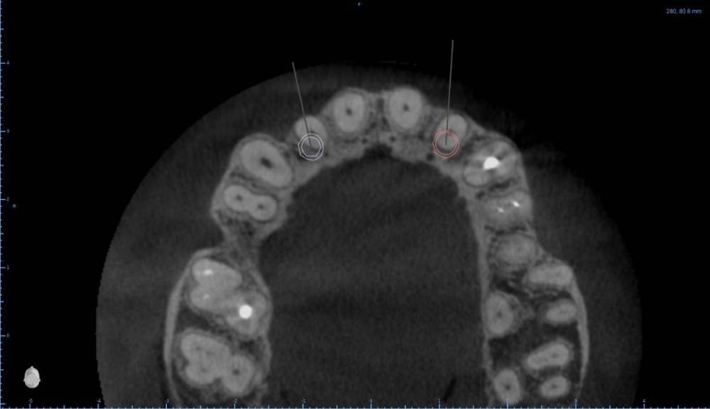 ����� ����� ������������8-Axial View.jpg
