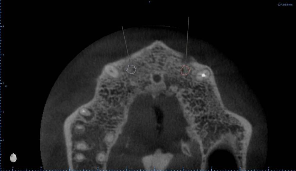 ����� ����� ������������5-Axial View.jpg