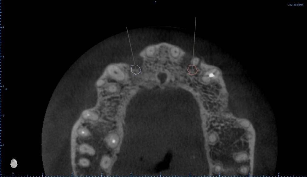 ����� ����� ������������6-Axial View.jpg