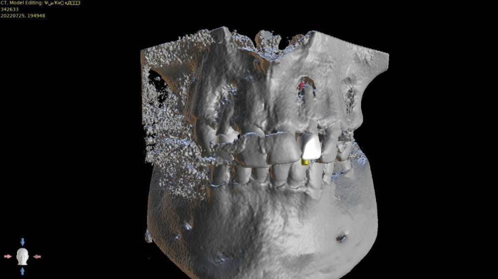 ����� ����� ������������9-3D View.jpg