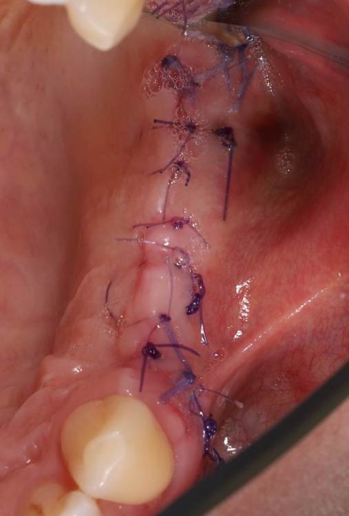 через 7 дней.jpg