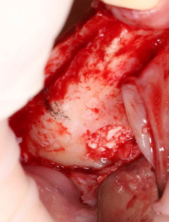 на операции.jpg