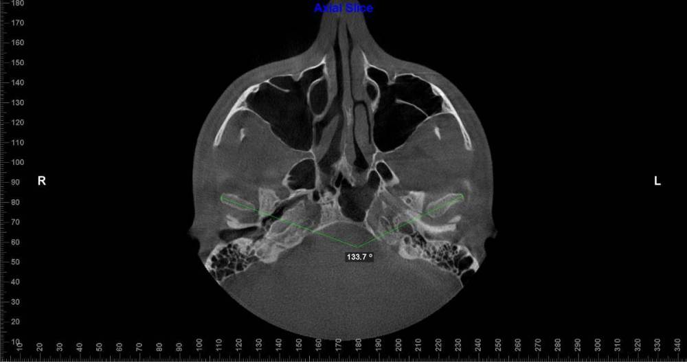 угол между внчс.jpg