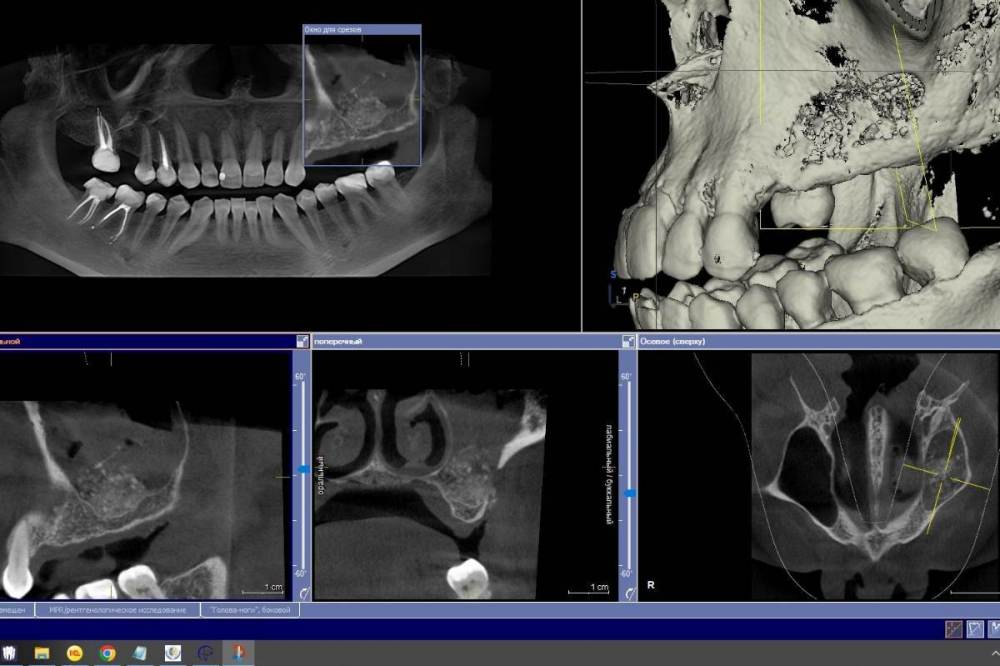 через 7 дней..jpg