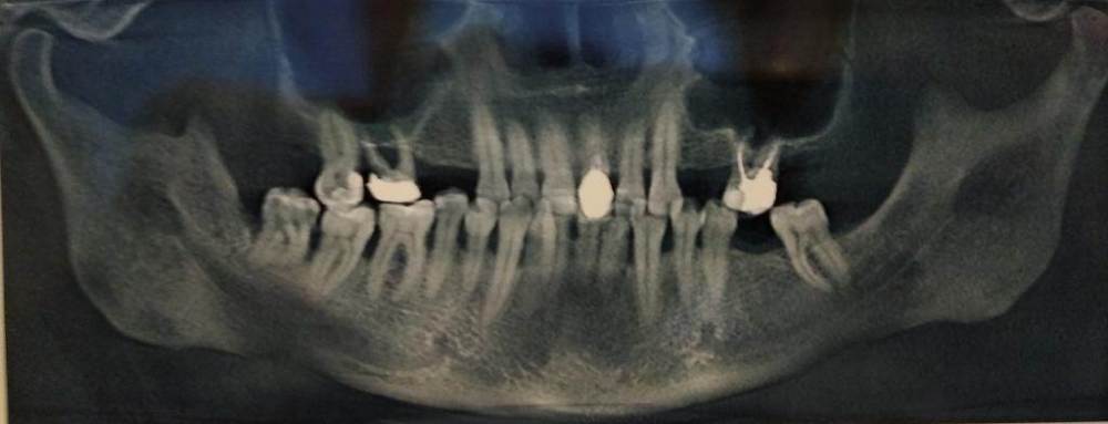 панорамный снимок.jpg