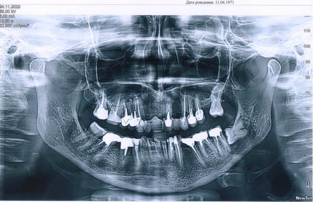 Света ЗУБЫ.jpeg