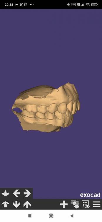 Screenshot_2023-01-19-20-38-28-620_com.exocad.webview.jpg