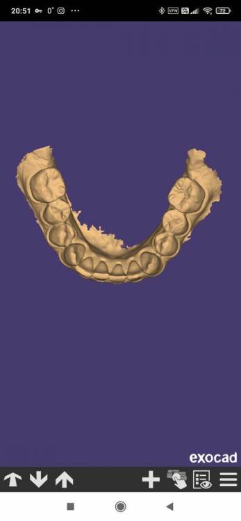 Screenshot_2023-01-19-20-51-00-112_com.exocad.webview.jpg