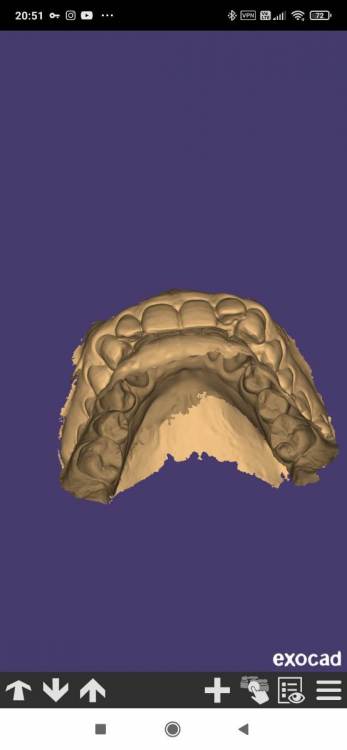 Screenshot_2023-01-19-20-51-46-876_com.exocad.webview.jpg