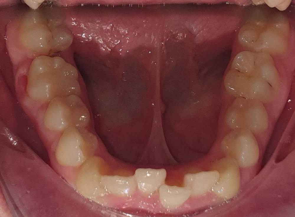 2. после снятия шины от 24.11.2021.jpg