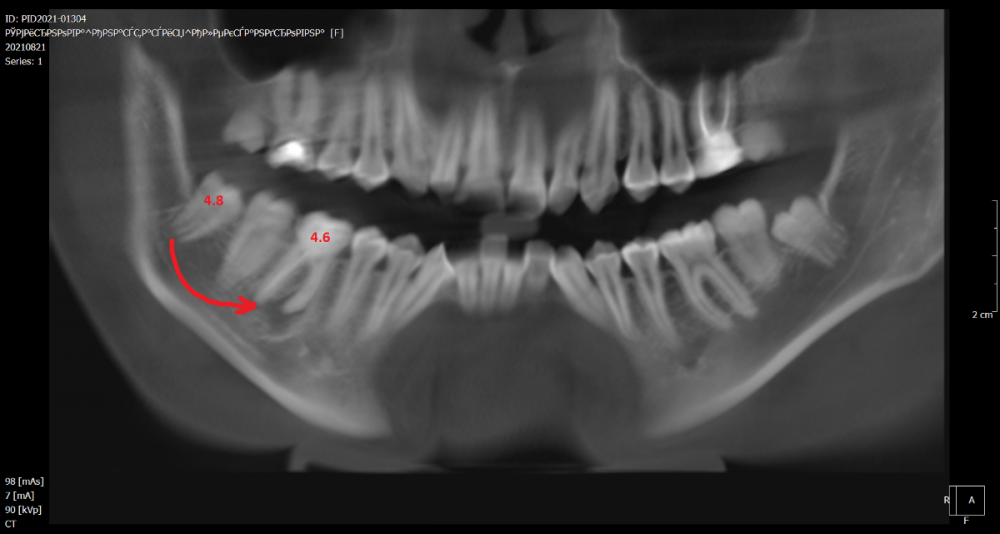 1. реконструкция.png
