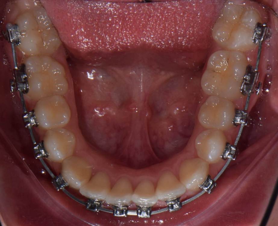 6. осмотр через год от 23.10.2022 0 00 00.jpg