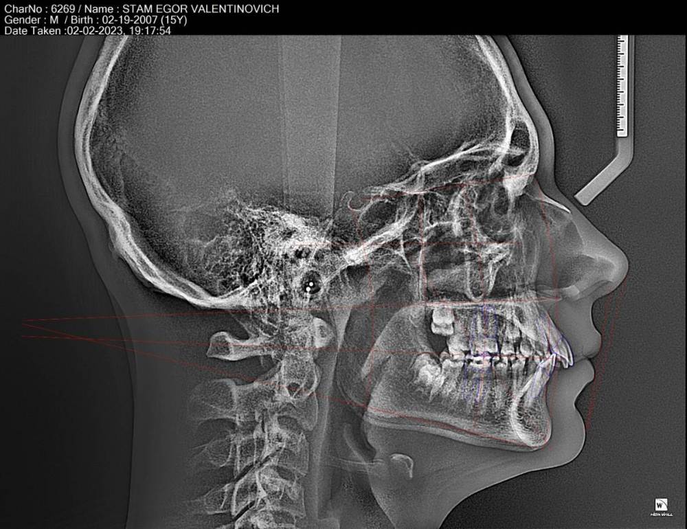 Стам Егор Валентинович ТРГ трассированная.jpg