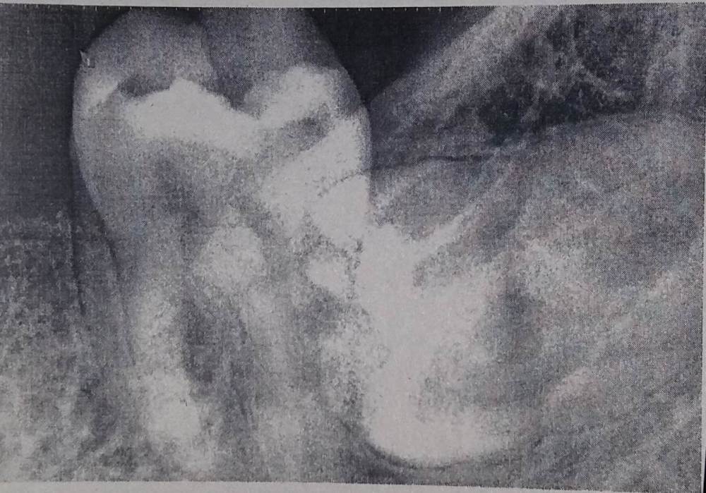 Фото зубов.jpg