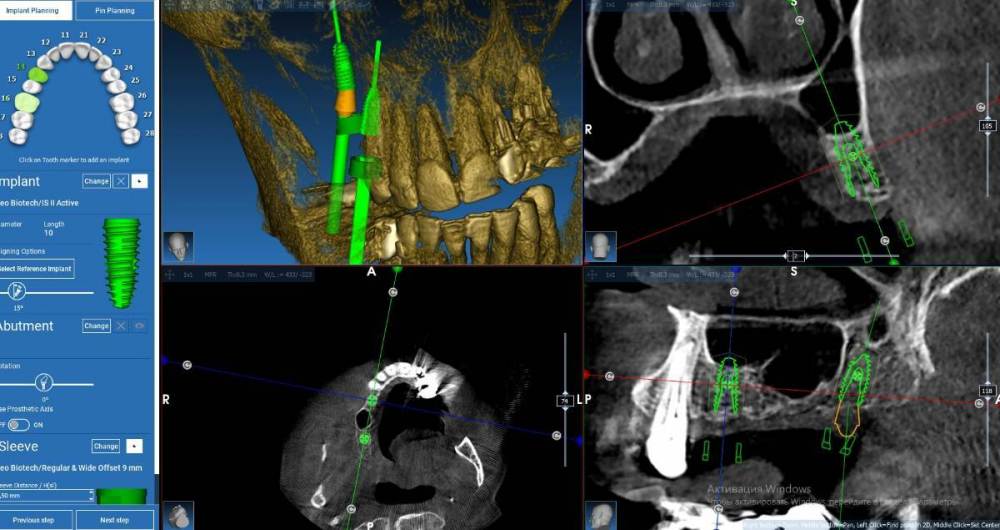 Скриншот 05-03-2023 180100.jpg