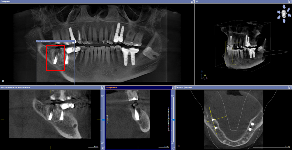 Скриншот 03-04-2023 102951.png