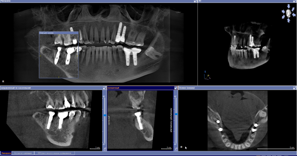 Скриншот 05-04-2023 093258.png