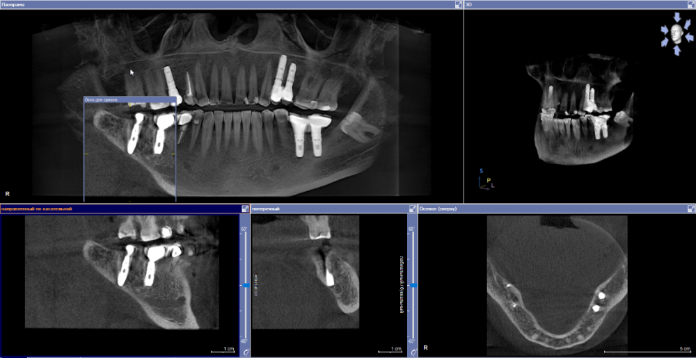 Скриншот 03-04-2023 151522.png