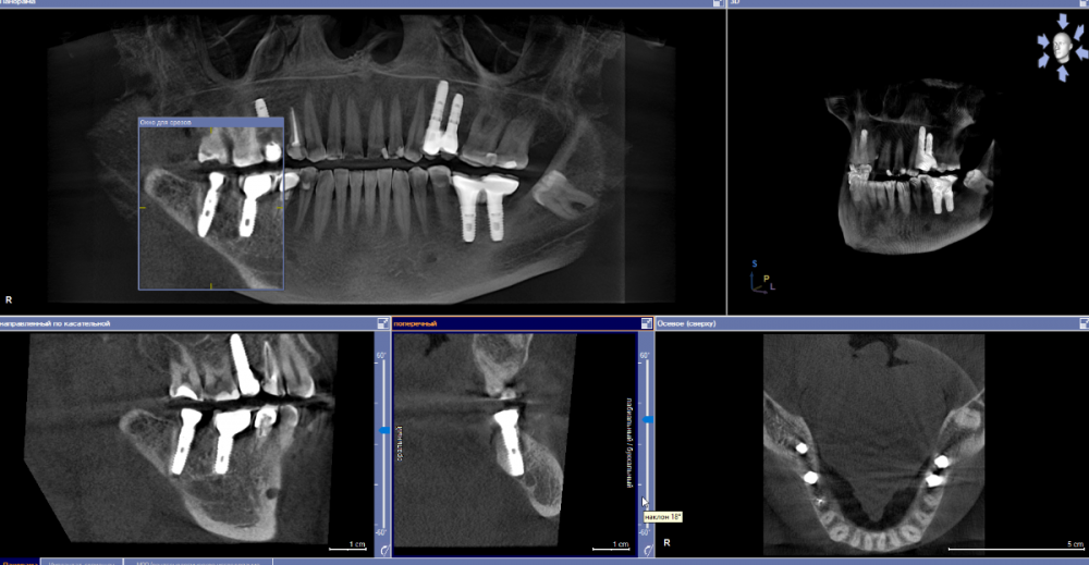 Скриншот 05-04-2023 093437.png