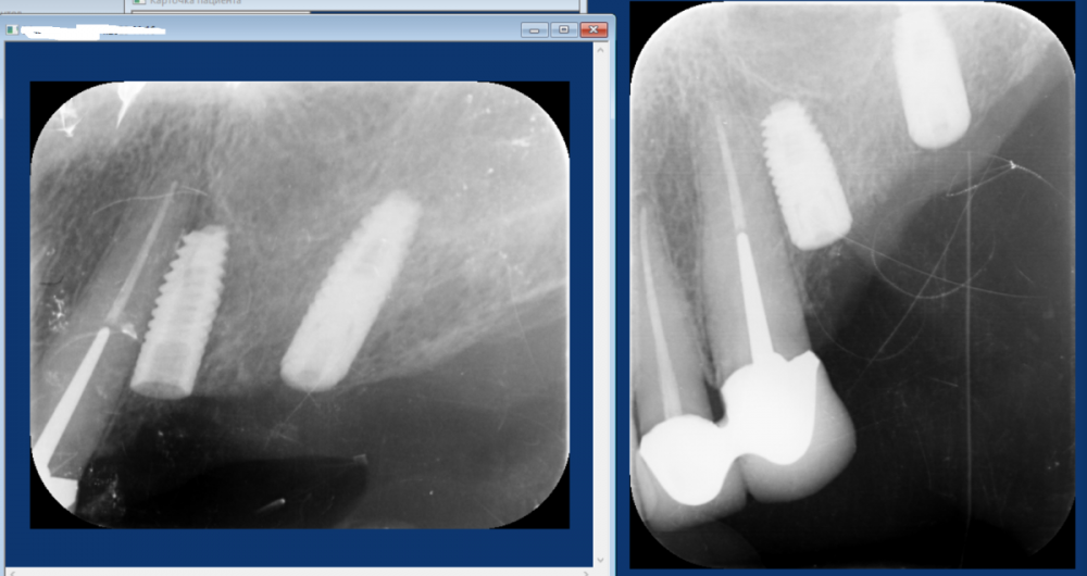 Как оставили.png