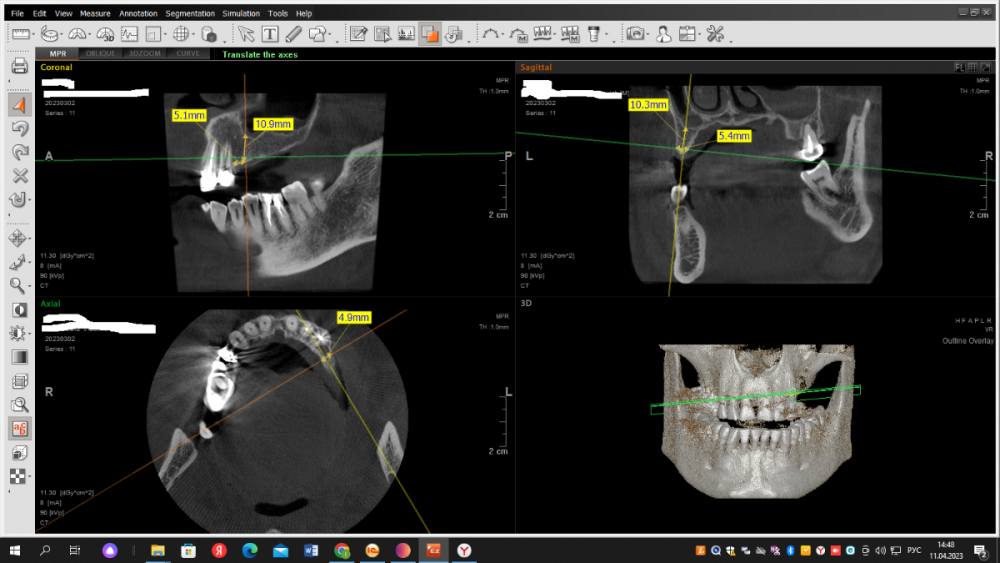 2023-04-11_14-48-51 - Copy.png