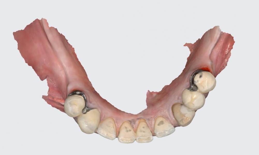 слизистая после.jpg