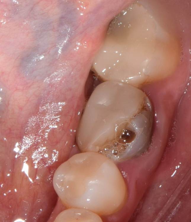 1. 3.6 до удаления.jpg