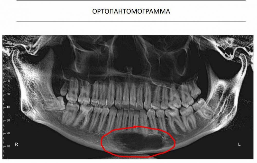 bandicam 2023-07-08 13-54-18-012.jpg