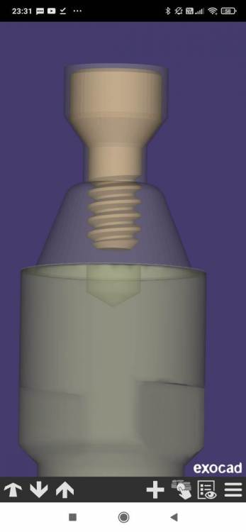 Screenshot_2023-07-24-23-31-58-437_com.exocad.webview.thumb.jpg.9f39fa58ac98da0400aba91f6a0a050b.jpg