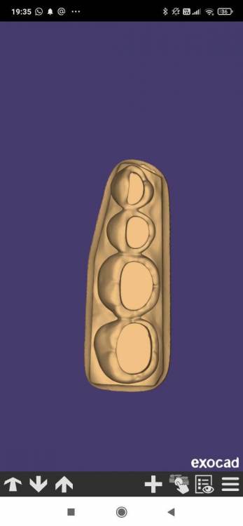 Screenshot_2023-07-30-19-35-14-181_com.exocad.webview.thumb.jpg.4a500901c33146c31b88fba26c93c516.jpg