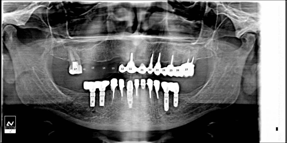 орто нумерация.jpg
