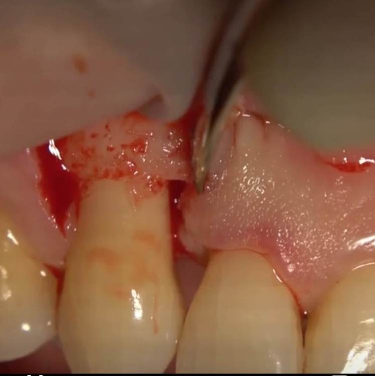 Screenshot_20230808_185451_Video Player.jpg