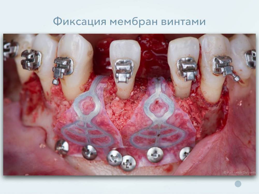 Тюляхова 31,42.006.jpeg