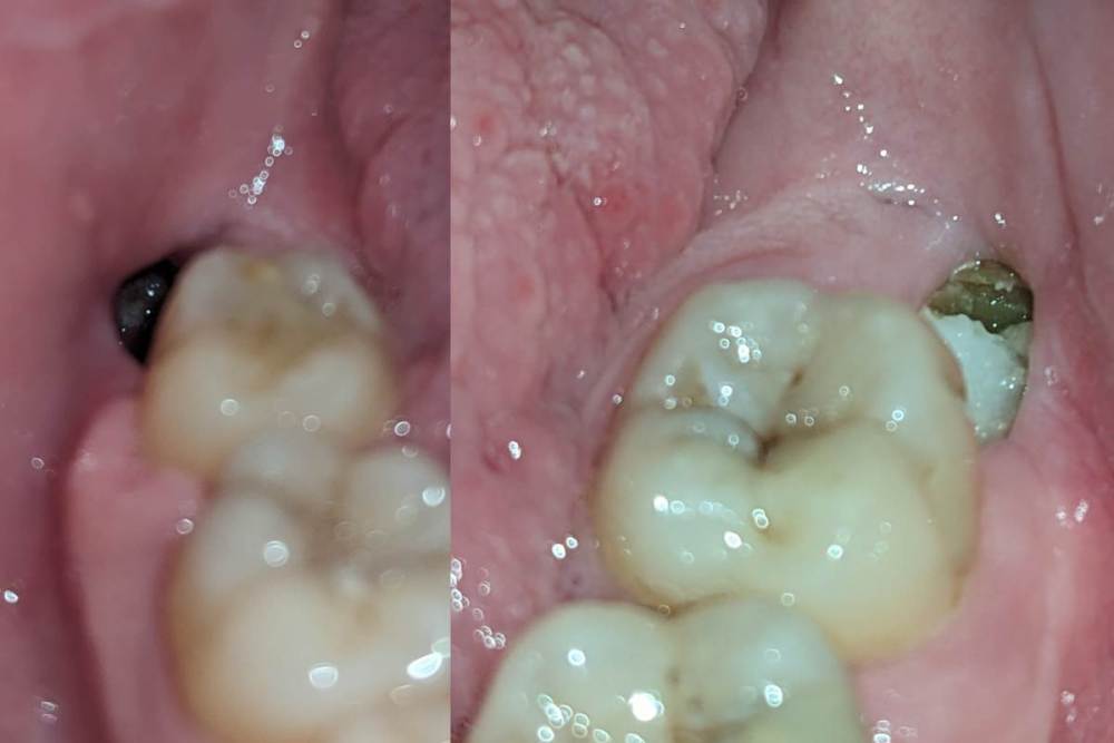 les cicatrices 2.jpg