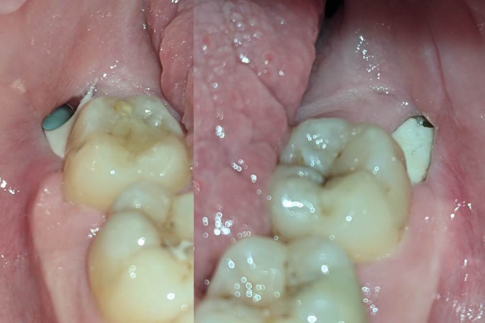 les cicatrices 5.jpg