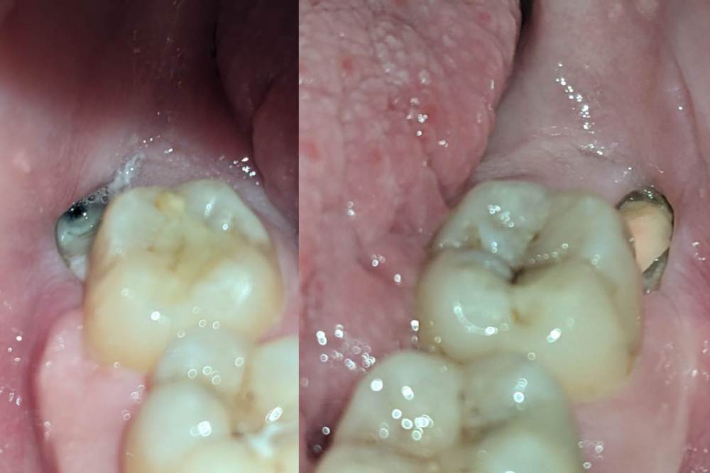 les cicatrices 3.jpg