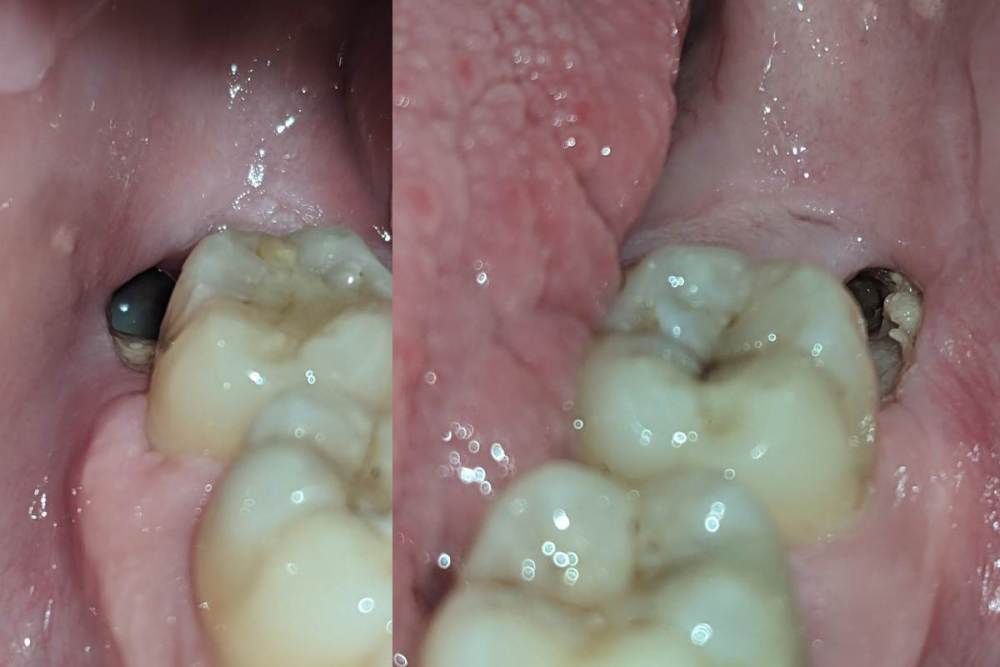 les cicatrices 4.jpg