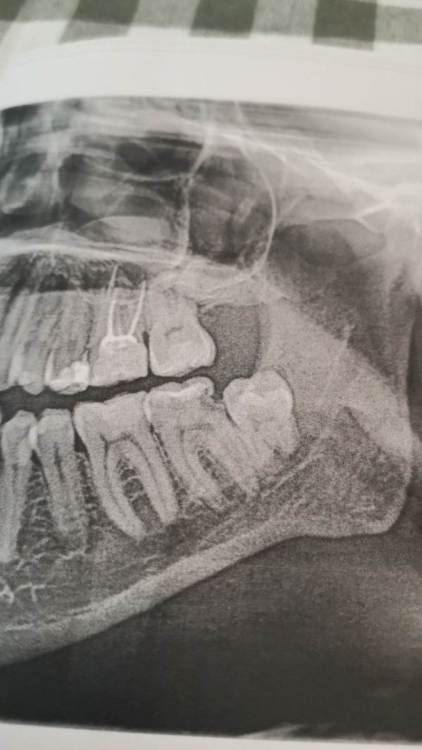 IMAGE 2023-12-24 22:50:32.jpg