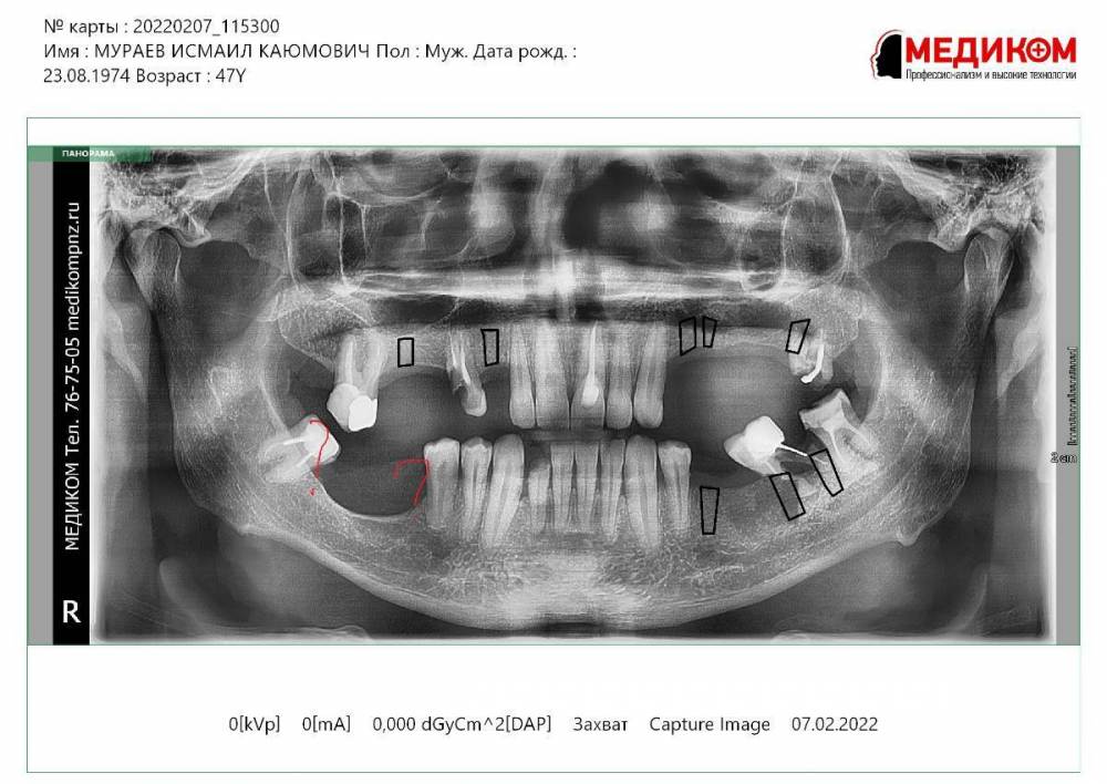 МУРАЕВ ИСМАИЛ КАЮМОВИЧ_07.02.2022115721.jpg