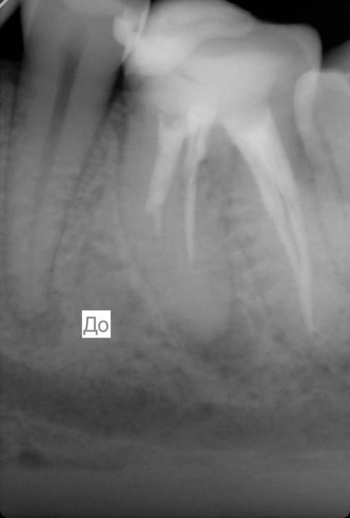 rtg 36 07.11.2022 ILONA BALUK(1).jpg