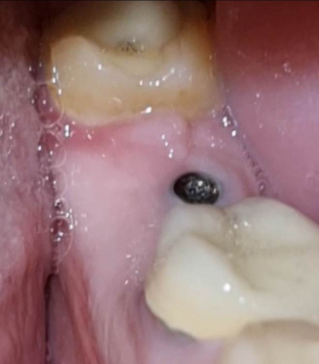 Screenshot_20240210_175501_Video Editor.jpg